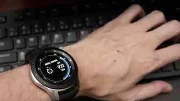 Homem denuncia que teve braço queimado por Galaxy Watch