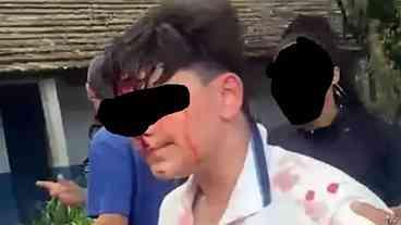 Estudante é agredido a pedradas por colega dentro de escola na Zona Norte