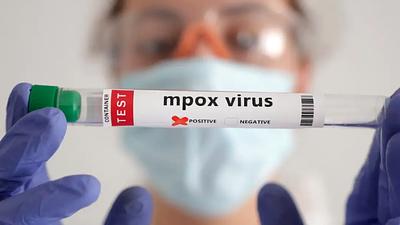 mpox-2.jpg