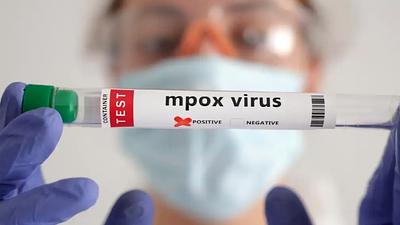 mpox-1.jpg